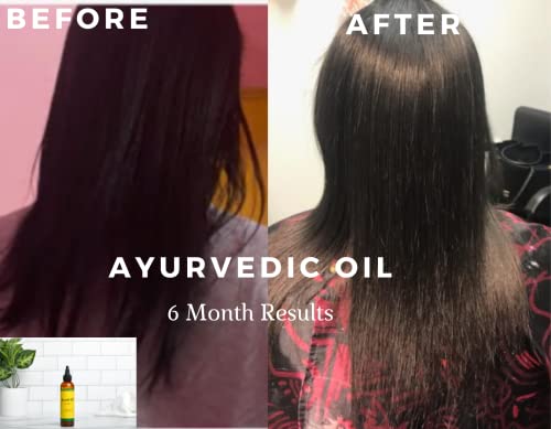 Ayurvedic Hair Growth Oil w/Neem, Fenugreek, Amla, Brahmi, Horsetail, Rosemary and Neem