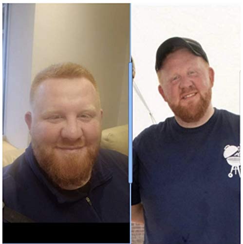 Ultra Greens Superfood Drink Mix – Natural Energy Supplement - Immune System Support Boost – Healthy Digestion Aid – Ultimate Brain Body Multi Vitamin Work Out Formula – Pre Post Gym Sports Or Daily