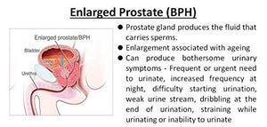 Advanta Supplements All Natural Prostate Supplement with Saw Palmetto Support Prostate Function