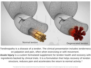 Acute Injury - "Delayed Release" Caps | Tendon & Ligament Support | Convenient Once a Day Clinical Dose | Boosts Tendon Health, Movement & Physical Function | Pharm (90 Capsules)